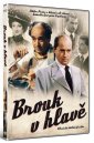 podgląd Brouk v hlavě - DVD